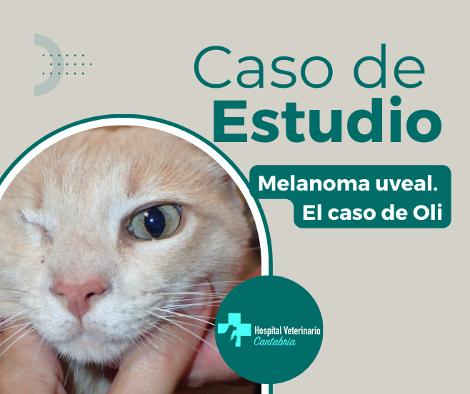 Melanoma uveal. Caso Clínico Oli